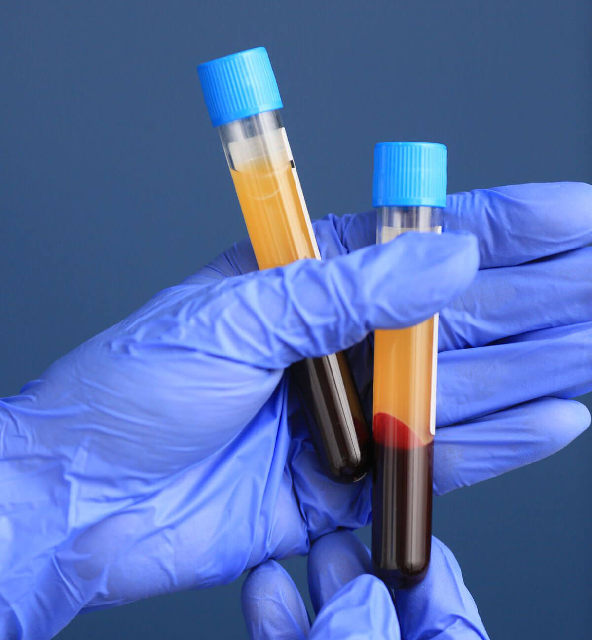 Плазмолифтинг лица